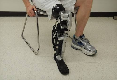 河南假肢安裝了小腿假肢后該如何進行訓(xùn)練走路和站立呢?(圖1)